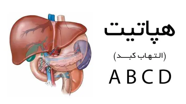 تشخیص بیماری هپاتیت با روش ترکیبی جدید مبتنی بر ماشین پشتیبان برداری و بازپخت SVM-SA